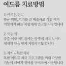 여드름 유형별 치료 방법 이미지