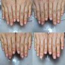 블리스유(BLISS U) | 강동구/성내동 블리스유 네일샵 Bliss U nail salon 2회차 후기 (손톱 교정, 후카즈메 교정)