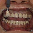 탑 치과기공소 이미지