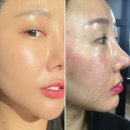 [ BABE 바베 ] 스페인약국클렌저/민감성/수딩젤클렌저