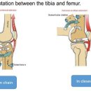우리들척추운동센터 이미지