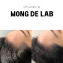 몽드랩 셀띠크30  삼성 이미지