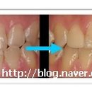 해맑은치과의원 이미지