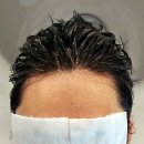 헤어도시압구정 | 도시의식탁｜압구정로데오 남자머리 잘하는곳 비오른헤어, 반곱슬 커트와 두피스케일링 만족했던 강남...
