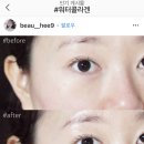 스킨메이드 이미지
