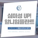 더센트럴치과의원 | 서산앞니임플란트 더센트럴치과의원에서!