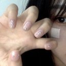 요비네일