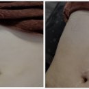 엘라 에스테틱 네이버블로그