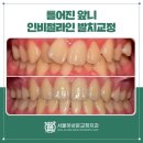 서울하상운치과교정과치과의원 이미지
