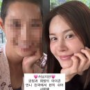 아이비
