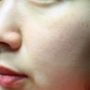 빅스메디