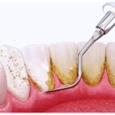 윈스치과의원 | 평촌치과추천? 광고에 지친 분께 드리는 말씀