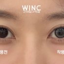 하늘빛투 이미지