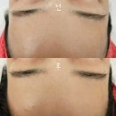 차앤박헤어 | 천안 피부관리 '오마주 21 스킨케어' 압출&amp;스킨플래닝 후기