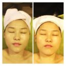 Sun테라피 이미지