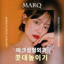 마크성형외과의원 이미지