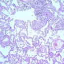 병소농장 | 과민성 폐렴