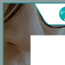 코엔박이비인후과의원 이미지