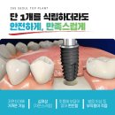 365서울탑플란트치과의원 이미지