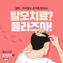 탈모의 원인, 탈모 치료, 플라즈마 탈모 시술 후기