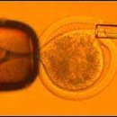 cloned human embryos 이미지