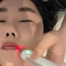 윙밸스킨