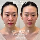 빅스페이스 이미지