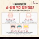 나도손톱 레푸스 개봉점 이미지