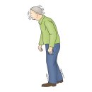 진행성 핵상마비9progressive supranuclear palsy0뇌신경정신질환 이미지