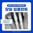 Y.S.C심미치과기공소 | 강남당일임플란트? 가능한 곳이 아닌 잘하는 곳으로