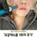 멍시티 | 부산 마린시티피부과 &#39;모공엑소좀 관리&#39; 스킨부스터 1회차 내돈내산후기