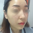 로뎀당구장 | 별내 피부관리/ J에스테틱 앰플케어 환절기 피부관리 후기