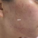 홈케어생명약국 | 아젤리아크림 효과 내돈내산 1달 사용 솔직후기!