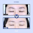 아우어성형외과의원 이미지