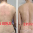 리치테라피 이미지