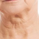 목주름 피부과 시술, 가로세로 목주름 원인과 관리 방법은 이미지