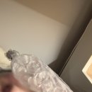 11260-4-14-7 | [편평사마귀 제거 후기] 동탄 CO2 얼굴 전체 제거 비용·통증·7일 경과