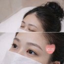 참인-코리아 | 강남눈썹문신 추천 유미코리아 뷰티센터 반영구 후기