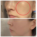 압구정역피부과 고우리부스터 너무 궁금해서 내 돈 내산 해서 다녀왔어요. 리얼 후기~!!! 갑니다.