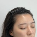 수원헤어라인커버-나리살롱 M자 헤어라인 커버 2주간의 솔직후기