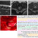 Congenital malformations of vertebral articular processes in dogs 이미지