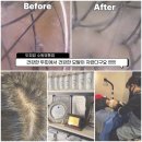 수원-2003 | 건강한 두피에서 건강한 모발이 자란다 [두피밥 수원영통점] 체험 후기