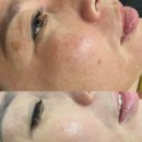 스킨파크 이미지