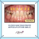 더스마일 치과기공소 이미지