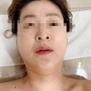 제 팔자주름 어디 갔죠? 김제 에스테틱 더가꿈 팔자주름 윤곽 관리 후기