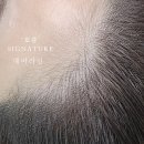 체인지헤어라인 이미지