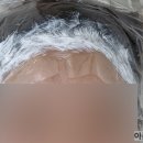 우태자헤어라인 | [성남/분당야탑] 야탑 여성 헤어라인 리니끄브로우 시술 솔직후기