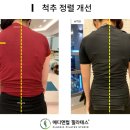 우정보조기 이미지