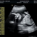 성희목장 | 27w🤰🏻+7kg