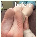바른체형교정마사지센터 네이버블로그